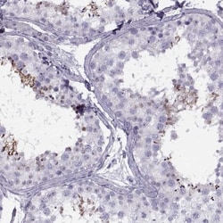 FAM24B Antibody, Novus Biologicals 25 &mu;L, Unlabeled:Antibodies, Polyclonal